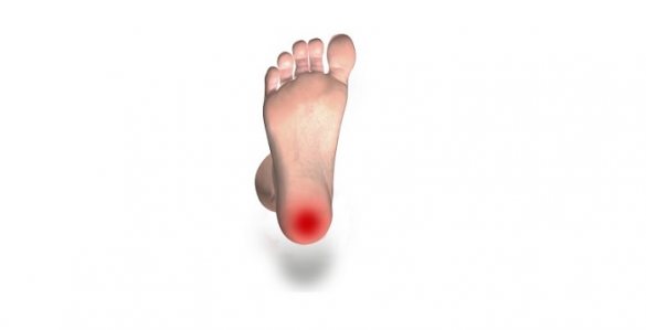 Illustration of foot with red area indicating foot pain caused by diabetes